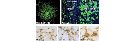 Buy Neurologic Rehabilitation: Neuroscience and Neuroplasticity in ...