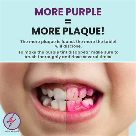 Plaque Disclosing Tablets for Teeth, 96 Count, Dental Disclosing ...