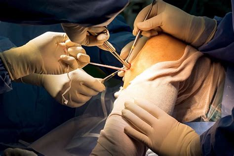 Arthroscopic Surgery | Trisha Hospital