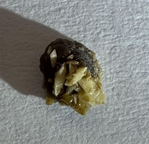 my husband passed a kidney stone tonight : r/TerrifyingAsFuck