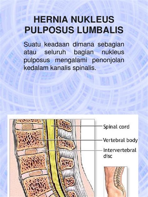 Pathway HNP | PDF