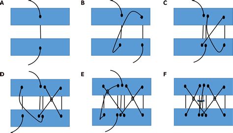 Efficacy And Safety Of Figure-of-eight Suture Versus Manual, 53% OFF
