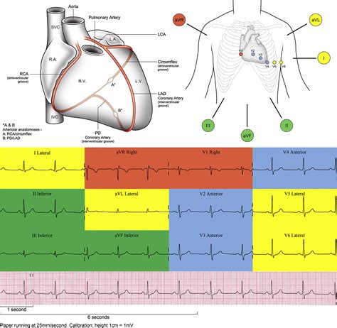 ECGs: Colour-coding for initial training - Resuscitation