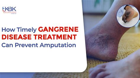 Cellulitis Symptoms : Early Warning Signs You Shouldn't Ignore