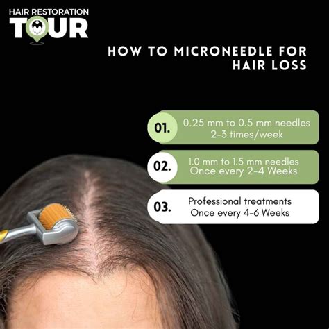 Microneedling For Hair Loss | Efficacy, Sides Effects, Cost