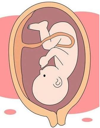 产检b超有两点基本是男孩（一分钟教你看懂孕期B超单，秒看怀的男宝还是女宝） | 说明书网