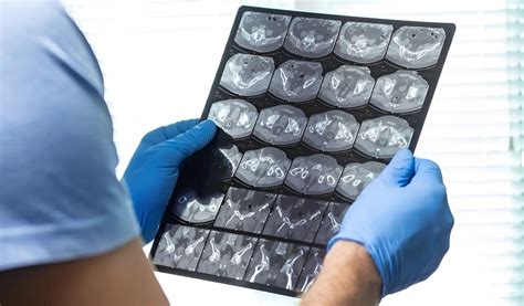 Neuro Physician in Pune – Best Neuro Physician at Deccan Hardikar Hospital