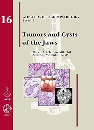 Buy Tumors and Cysts of the Jaws Book Online at Low Prices in India ...