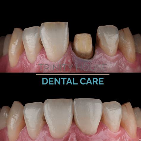 Smile Gallery - Trinity House Dental Care