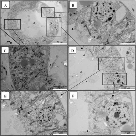 PirABVP Toxin Binds to Epithelial Cells of the Digestive Tract and ...