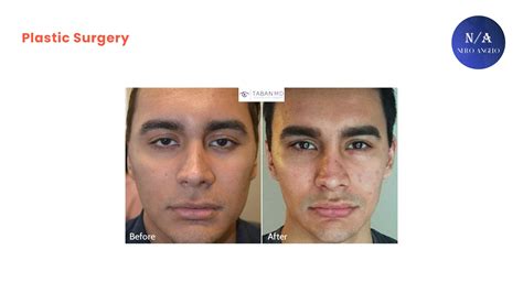 How To Get Hunter Eyes