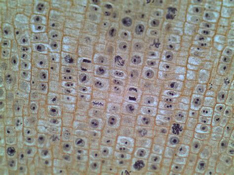 Stages Of Mitosis In Onion Root Tip