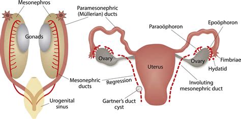 Imaging Evaluation of Fallopian Tubes and Related Disease: A Primer for ...