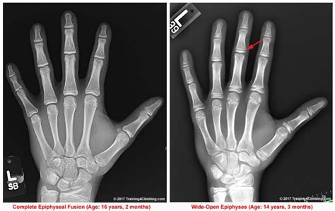 Image result for Appendix with Screen Shot Example