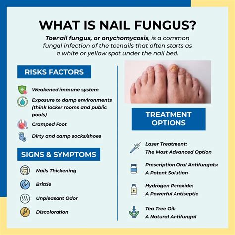What Kills Foot Fungus Instantly