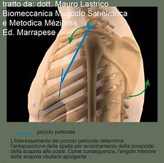 gabbia toracica sporgente istituto superiore di posturologia neuro mio fasciale aifimm gabbia toracica sporgente istituto superiore di posturologia neuro mio fasciale aifimm