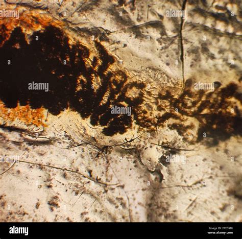 What Do Pinworms Look Like In Poop at Jasper Gunson blog