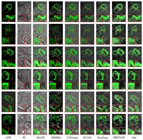 MDC-RHT: Multi-Modal Medical Image Fusion via Multi-Dimensional Dynamic ...