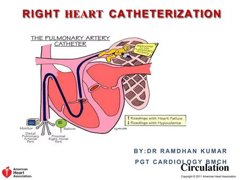 RIGHT HEART CATHETERISTION 1.ppt