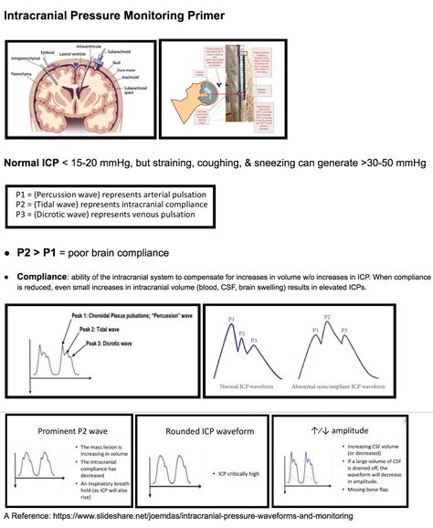 Intracranial Pressure Monitoring Chart Easy