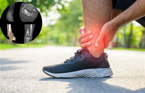 CT Scan Example 的图像结果