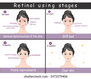 How to Apply Tretinoin, According to Dermatologists Vector Art