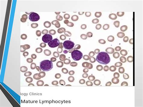 CBC Lab Panel 的图像结果