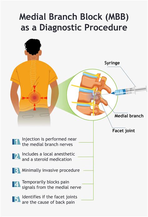Medial Branch Block Injection