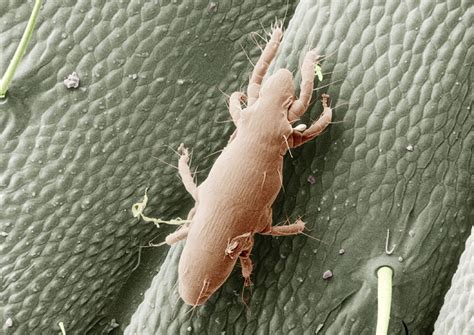 Oak-mite bites may be cicadas’ latest gift to D.C. region - The ...