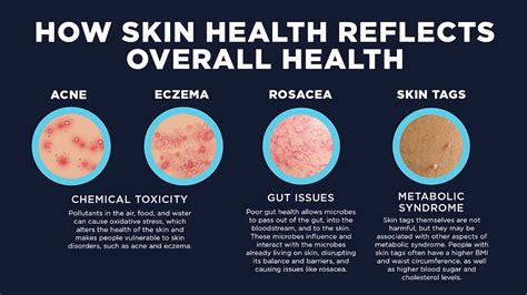 Image result for Different Types of Skin Conditions