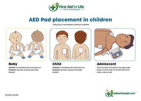 New 2025 guidance for paediatric resuscitation and first aid