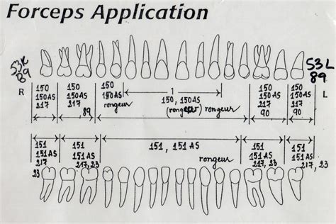 Dental Forceps Chart
