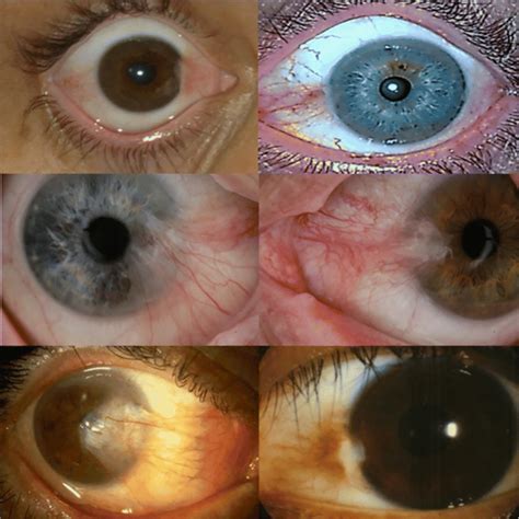 Image result for Iris Recognition Using MATLAB Source Code