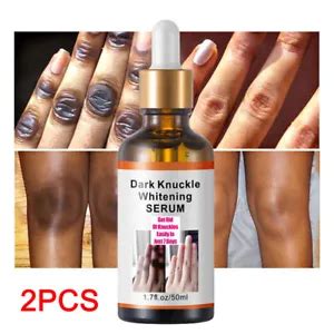 2-Pack Knuckle & Elbow Whitening Serum for Smoother, Brighter Skin in 7 ...