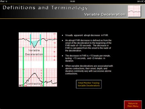 Electronic Fetal Heart Rate Monitoring iPad medical app review