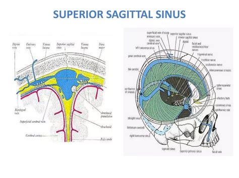 Superior Sagittal Sinus