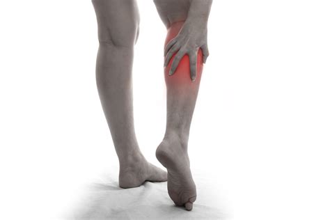 Calf Muscle Tears - London Sports Orthopaedics