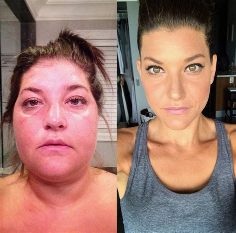Living and Fighting with Two Diseases - Danielle's Story - Brain Tumour Foundation of Canada