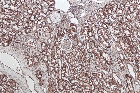 IHCeasy SFRP1 Ready-To-Use IHC Kit KHC0215 | Proteintech