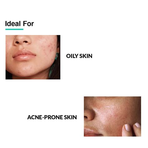 Fixderma Salicylic Acid Serum Best For Your Acne Solution – Fixderma ...