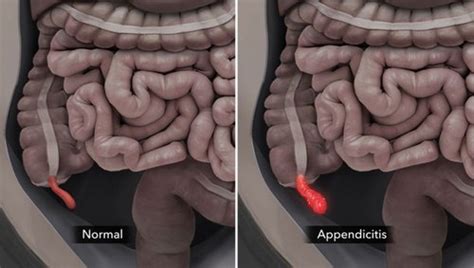 Image result for Appendix Example Website