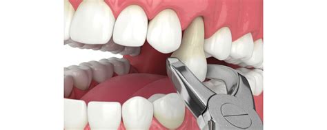 Best Oral & Maxillofacial Surgeon in Bandra & Chembur @KKMDC Dental Clinic