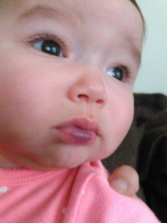 Bottom lip purpleish bruise? | BabyCenter