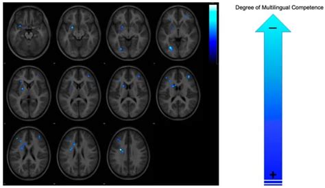 The Neurodevelopmental Dynamics of Multilingual Experience During ...