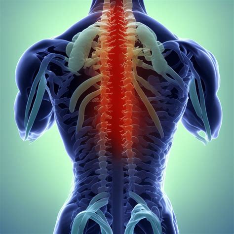 Vertebrogenic low back pain | M54.51 | DX
