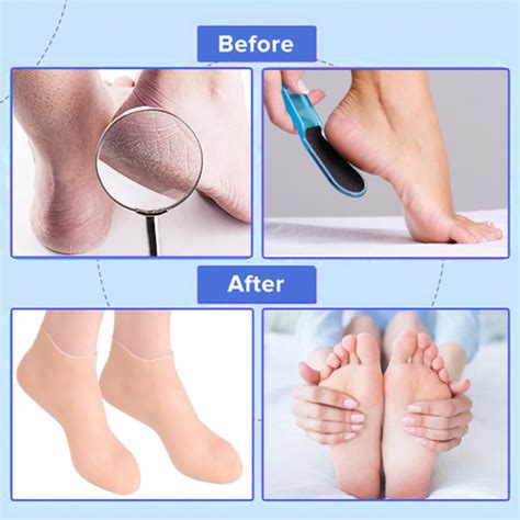 Dr Foot Silicone Socks |Dry Cracking Skin | Unisex | Full Length, Large ...