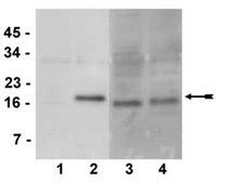 Anti-phospho-CENP-A (Ser7) Antibody, clone NL41, rabbit monoclonal ...