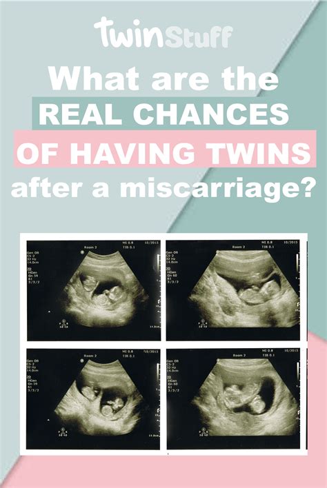 Odds of having twins and odds of having twins after twins faq – Artofit