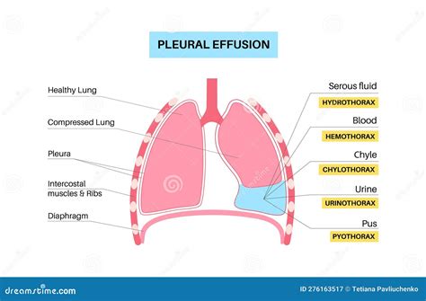 Lung Pleura