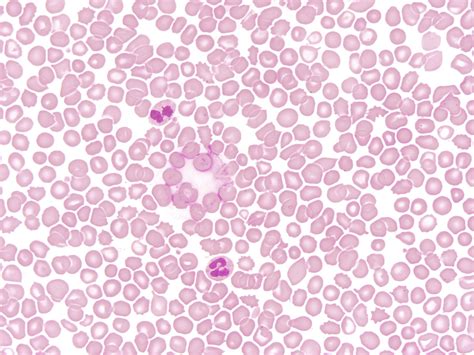 Red Blood Cell Microscope 100x